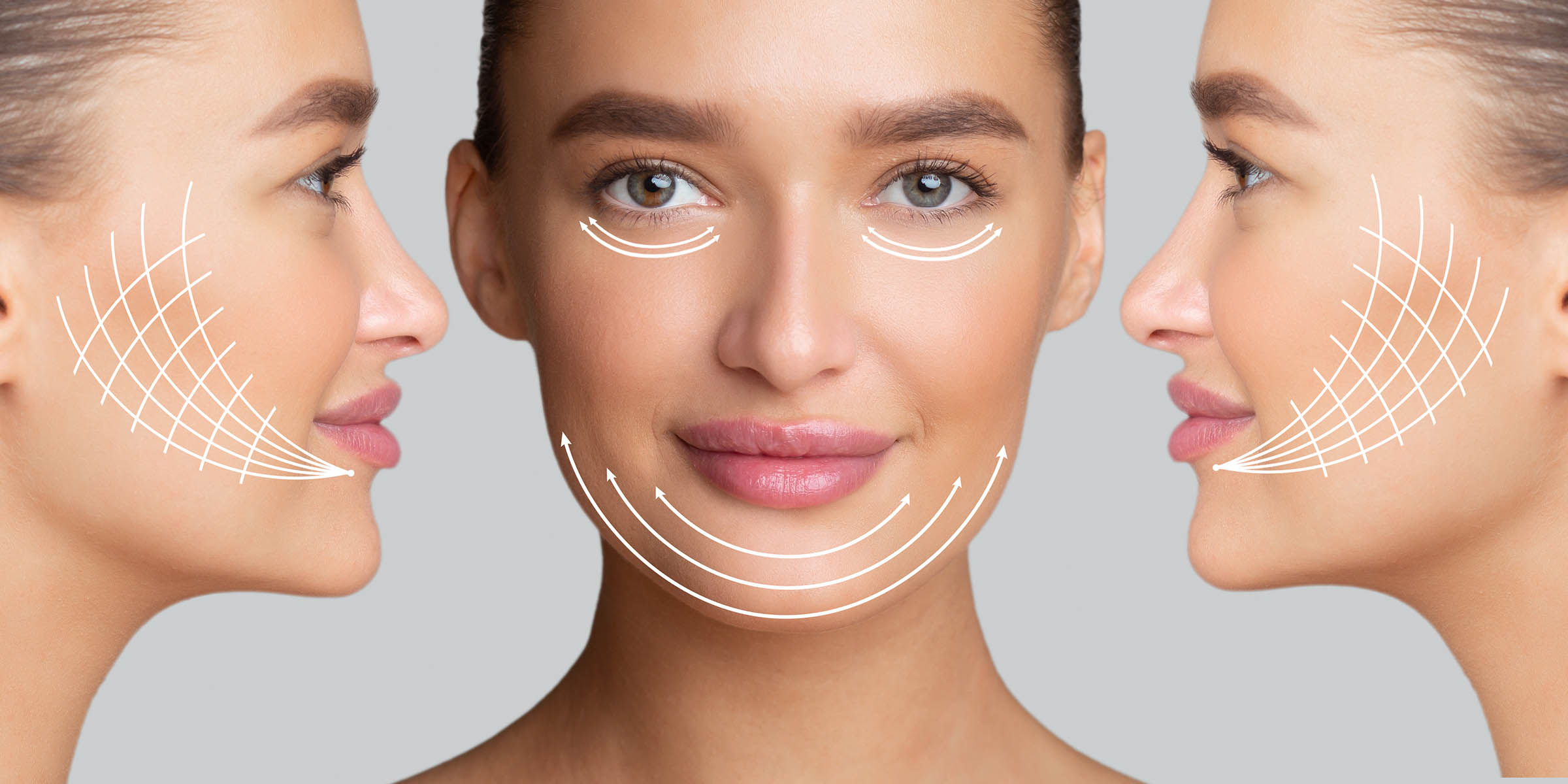 Facelift & Necklift